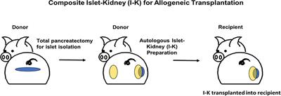 Combined islet and kidney xenotransplantation for diabetic nephropathy: an update in ongoing research for a clinically relevant application of porcine islet transplantation